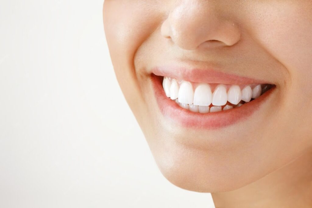 Orthodontie adulte en 2026 : aligneurs ou bagues : le guide complet