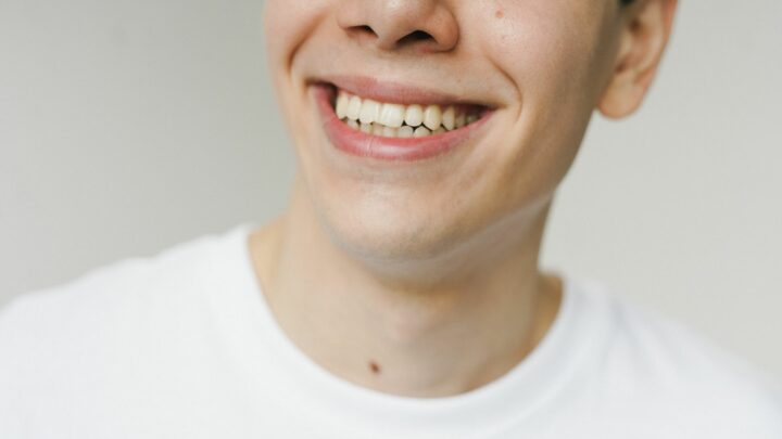 Sourire d'un patient après la pose d'une couronne dentaire