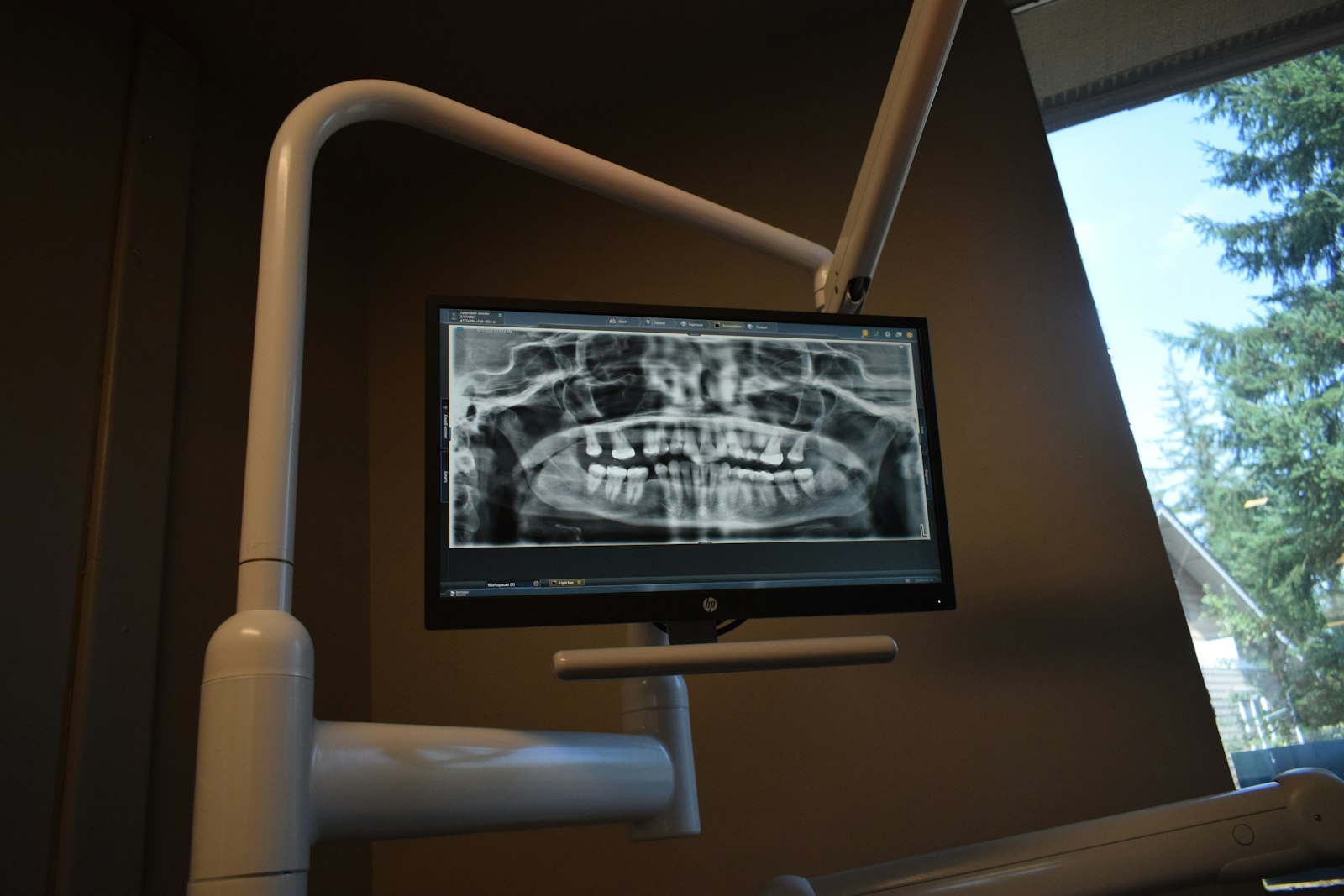 La radiographie dentaire : un tiers des actes d'imagerie, 0,3 % des doses reçues