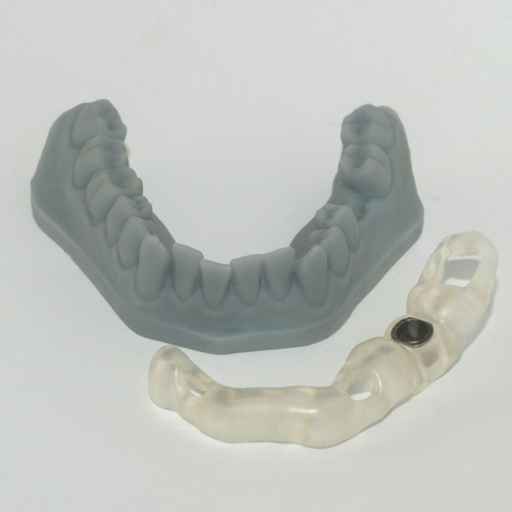 cabinet-dentaire-les-tilleuls-technologies-chirurgie-guidee