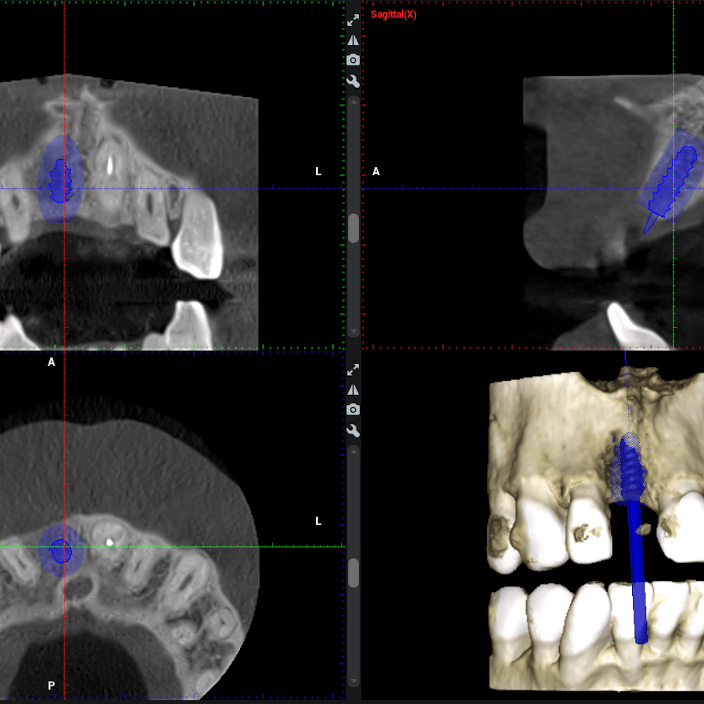 cabinet-dentaire-les-tilleuls-technologies-cone-beam