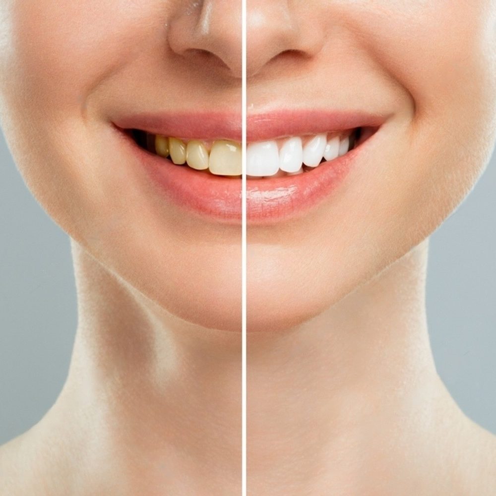 cabinet-dentaire-les-tilleuls-technologies-planification-esthetique-smile-design